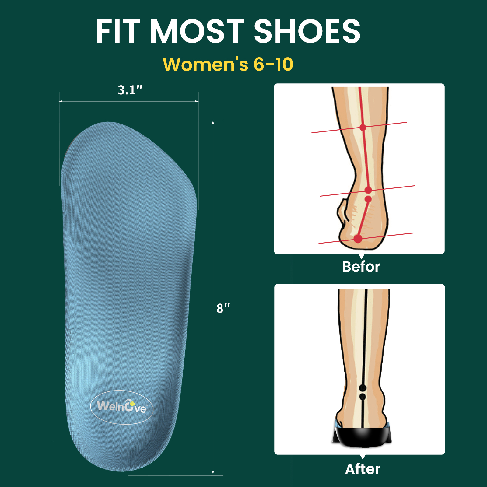 2pcs Female Arch Support Pad O - Insole Arch Support recension och pris